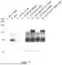 Fig. 06 - ADENO-ASSOCIATED VIRUSES AND METHODS AND MATERIALS FOR MAKING AND USING ADENO-ASSOCIATED VIRUSES