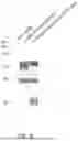 Fig. 07 - ADENO-ASSOCIATED VIRUSES AND METHODS AND MATERIALS FOR MAKING AND USING ADENO-ASSOCIATED VIRUSES