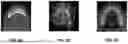 Fig. 03 - METHOD OF SEGMENTING COMPUTED TOMOGRAPHY IMAGES OF TEETH
