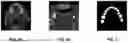 Fig. 04 - METHOD OF SEGMENTING COMPUTED TOMOGRAPHY IMAGES OF TEETH