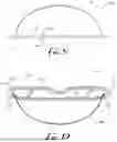 Fig. 07 - Radiation shielding eye mask and method of use
