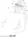 Fig. 09 - Radiation shielding eye mask and method of use