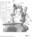 Fig. 02 - ROBOTIC ASSISTED IMAGING