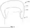 Fig. 10 - SYSTEM AND METHOD FOR FABRICATING A DENTAL RESTORATION