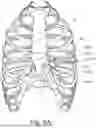 Fig. 09 - SUBCUTANEOUS DEVICE WITH ANCHORING ARMS