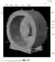 Fig. 02 - PHANTOM AND ASSOCIATED SYSTEMS AND METHODS FOR STEREOTACTIC BODY RADIATION THERAPY (SBRT)