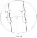 Fig. 03 - Universal vehicle passenger restraint system