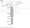 Fig. 01 - Centralizer for downhole probes