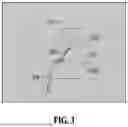 Fig. 04 - METHOD AND APPARATUS FOR ANALYZING BLOOD VESSEL BASED ON MACHINE LEARNING MODEL