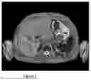 Fig. 02 - METHOD OF ANALYSING MEDICAL IMAGES