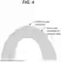 Fig. 05 - SYSTEM AND METHOD OF ADJUSTING DENTAL APPLIANCES USING ADDITIVE MANUFACTURING