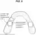 Fig. 09 - SYSTEM AND METHOD OF ADJUSTING DENTAL APPLIANCES USING ADDITIVE MANUFACTURING