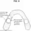 Fig. 10 - SYSTEM AND METHOD OF ADJUSTING DENTAL APPLIANCES USING ADDITIVE MANUFACTURING