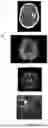 Fig. 06 - STROKE DIAGNOSIS AND THERAPY ASSISTANCE SYSTEM, STROKE STATE INFORMATION PROVIDING DEVICE, AND STROKE STATE INFORMATION PROVIDING PROGRAM