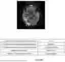 Fig. 15 - STROKE DIAGNOSIS AND THERAPY ASSISTANCE SYSTEM, STROKE STATE INFORMATION PROVIDING DEVICE, AND STROKE STATE INFORMATION PROVIDING PROGRAM
