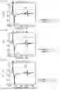 Fig. 06 - ACOUSTIC WAVE DEVICE, FILTER, MULTIPLEXER, AND WAFER