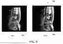 Fig. 06 - System and method for improved metal detection in magnetic resonance imaging