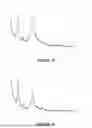 Fig. 07 - HOMOGENEOUS BIOPOLYMER SUSPENSIONS, PROCESSES FOR MAKING SAME AND USES THEREOF