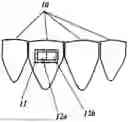 Fig. 01 - Method And Apparatus For Preventing Plaque, Calculus, And Hard Deposits In Body Cavities And The Mouth