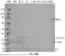 Fig. 72 - THERAPEUTIC OLIGONUCLEOTIDES