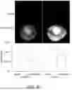 Fig. 07 - VECTOR-MEDIATED IMMUNE TOLERANCE IN THE EYE