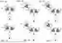 Fig. 02 - BISPECIFIC T CELL ACTIVATING ANTIGEN BINDING MOLECULES