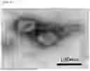 Fig. 02 - NOVEL BACTERIOPHAGE HAVING ENTEROTOXIGENIC ESCHERICHIA COLI-SPECIFIC BACTERICIDAL EFFECT AND ANTIBACTERIAL COMPOSITION COMPRISING SAME
