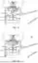 Fig. 10 - Water conservation faucets