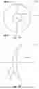 Fig. 02 - OPHTHALMIC LENS INCLUDING A PERIPHERAL ZONE HAVING AN ADD-POWER OFFSET AND A SPATIALLY-MODULATED OPTICAL PARAMETER