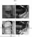 Fig. 02 - APPARATUS AND METHOD FOR IMPROVING NO-FLASH IMAGE QUALITY USING FLASH IMAGE