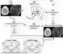 Fig. 01 - Systems and methods for whole-brain circuit- based neurostimulation to treat brain disorders