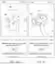 Fig. 11 - METHOD, PROGRAM, AND SYSTEM FOR 3D SCANNING