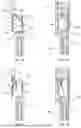 Fig. 02 - Clamping spring-type contact device having an overstretch prevention mechanism, and plug connector insert having at least one such clamping spring-type contact device