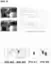 Fig. 04 - Motion information prediction method and apparatus for distortion due to projection formation conversion