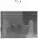 Fig. 04 - IMAGE ENCODING METHOD USING A SKIP MODE, AND A DEVICE USING THE METHOD