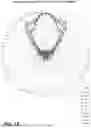 Fig. 20 - PHASING PLUG ADAPTOR