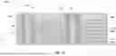 Fig. 04 - Microelectronic devices comprising stack structures having pillars and elliptical conductive contacts