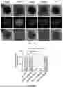 Fig. 02 - METHOD FOR IMPROVING THE EFFECT OF THE OOCYTE CRYOPRESERVATION BY REDUCING THE MITOCHONDRIAL TEMPERATURE
