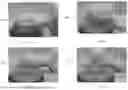 Fig. 03 - PILLOW FOR PERFORMING ROLL MANEUVER