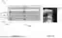 Fig. 03 - SYSTEM AND METHOD FOR DETECTING PNEUMOTHORAX