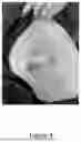 Fig. 05 - SYSTEM AND METHOD FOR DETECTING PNEUMOTHORAX