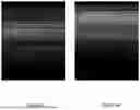 Fig. 07 - SYSTEM AND METHOD FOR DETECTING PNEUMOTHORAX