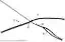 Fig. 01 - SUTURE CONSTRUCT