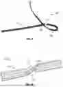 Fig. 07 - SUTURE CONSTRUCT