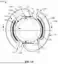 Fig. 02 - SYSTEM AND METHODS OF ADJUSTING INTRAOCULAR LENSES WITH OPTICAL COHERENCE TOMOGRAPHY GUIDANCE