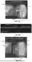 Fig. 09 - SYSTEM AND METHODS OF ADJUSTING INTRAOCULAR LENSES WITH OPTICAL COHERENCE TOMOGRAPHY GUIDANCE