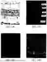 Fig. 27 - METHODS OF PRODUCING HUMAN RPE CELLS AND PHARMACEUTICAL PREPARATIONS OF HUMAN RPE CELLS