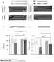 Fig. 35 - TREATING DISORDERS ASSOCIATED WITH DYRK1A DYSFUNCTION