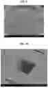 Fig. 06 - SKIN MICROENVIRONMENT TARGETED DELIVERY FOR PROMOTING IMMUNE AND OTHER RESPONSES