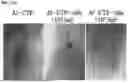 Fig. 37 - SPONTANEOUS RESPIRATORY BIOMATERIAL FOR TISSUE ENGINEERING